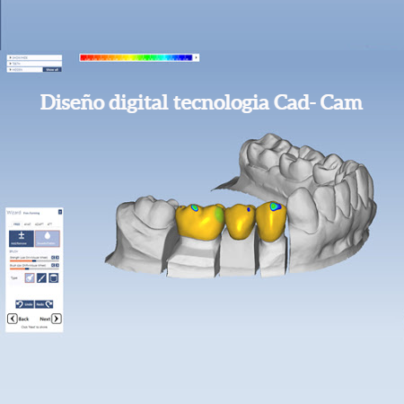 Identic Lab CADCAM